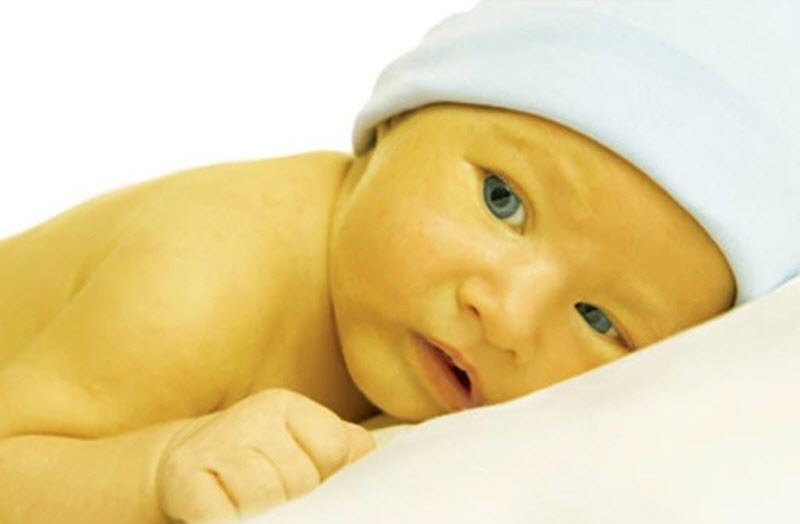 Mẹo dân gian chữa vàng da ở trẻ sơ sinh đơn giản các mẹ nên biết